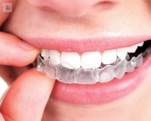 ortodoncia-invisible-un-sistema-con-proposito-estetico-y-funcional imagen de artículo