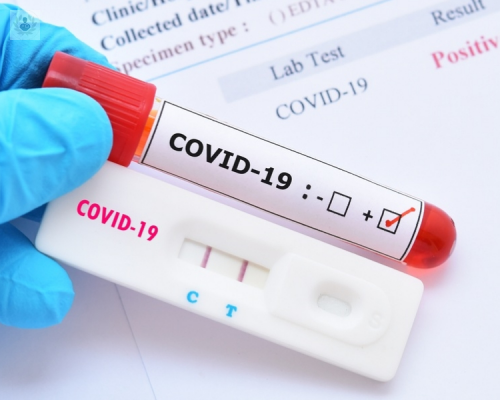 Prueba rápida para medir los niveles de anticuerpos: ¿realmente detecta el Coronavirus?