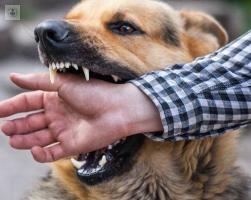 rabia-como-afecta-al-ser-humano imagen de artículo