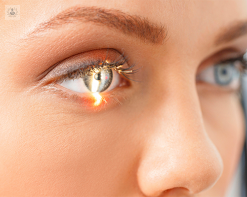 Conoce todo sobre la Vitrectomía, una microcirugía ocular exitosa