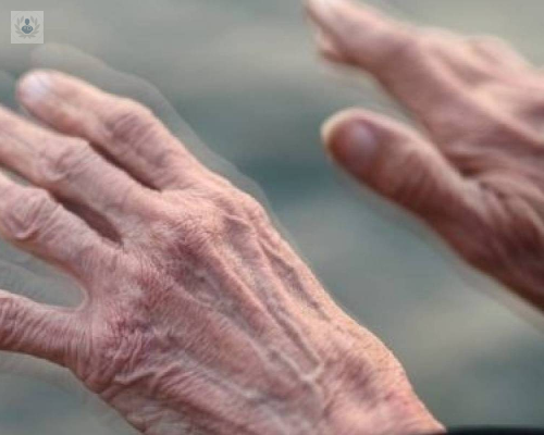 sars-cov-2-y-su-relacion-con-el-parkinson imagen de artículo