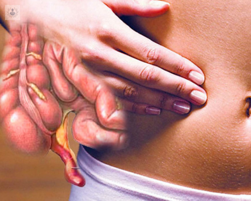 apendicitis-aguda-importancia-operarse-a-tiempo imagen de artículo