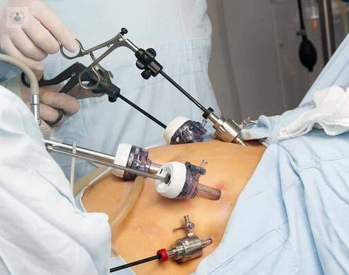 bypass-gastrico-operacion-provoca-mayor-remision-diabetes imagen de artículo