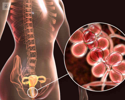 esterilidad-asociada-a-la-endometriosis imagen de artículo