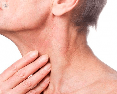 mejor-tratamiento-tumor-cuello imagen de artículo