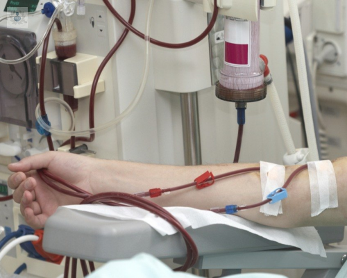 hemodialisis-procedimiento-contra-la-insuficiencia-renal imagen de artículo