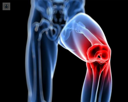 cirugia-articular-elimina-dolor-siempre imagen de artículo