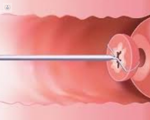 sabes-que-es-la-displasia-cervical imagen de artículo