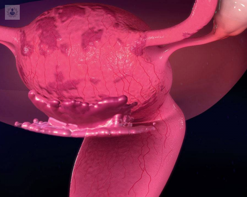 endometriosis-de-las-principales-causas-que-impiden-el-embarazo imagen de artículo