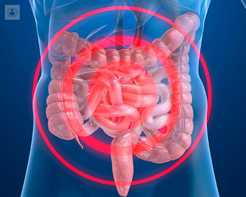 descubren-farmaco-para-tratar-la-enfermedad-intestinal-inflamatoria imagen de artículo