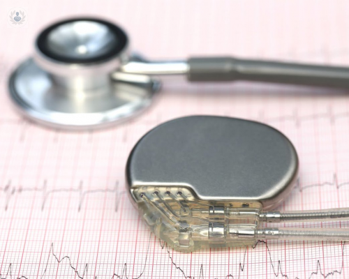 como-funciona-un-marcapasos-descubra-todos-los-detalles imagen de artículo