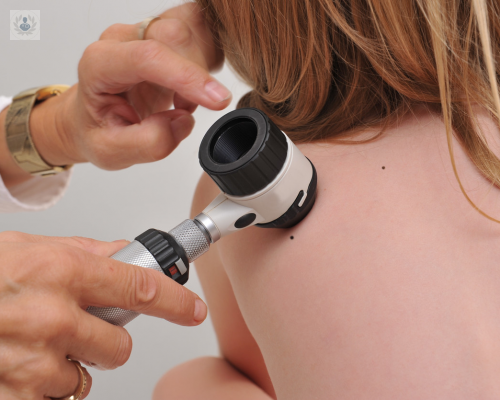 curetaje-en-dermatologia-conoce-todos-los-detalles imagen de artículo