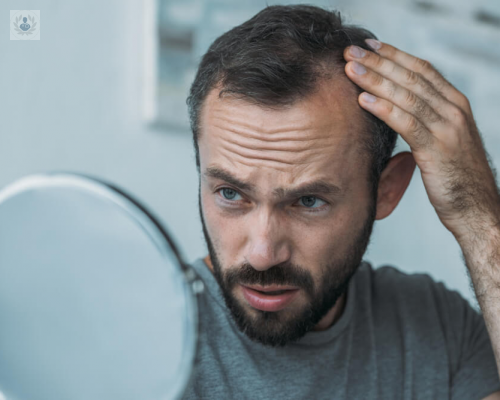 Alopecia o caída del cabello: causas y tratamiento