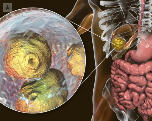 estados-unidos-se-declaro-en-alerta-debido-al-aumento-de-casos-de-equinococosis-alveolar-em imagen de artículo