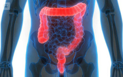 Síndrome del intestino irritable: síntomas, causas y tratamiento