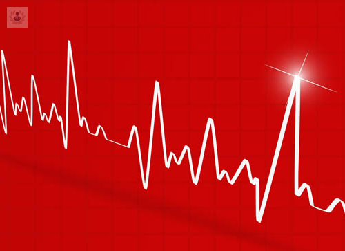 las-taquicardias-que-son-sintomas-y-tratamiento imagen de artículo