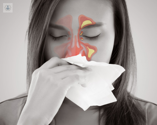 Sinusitis: un tratamiento adecuado puede evitar graves consecuencias