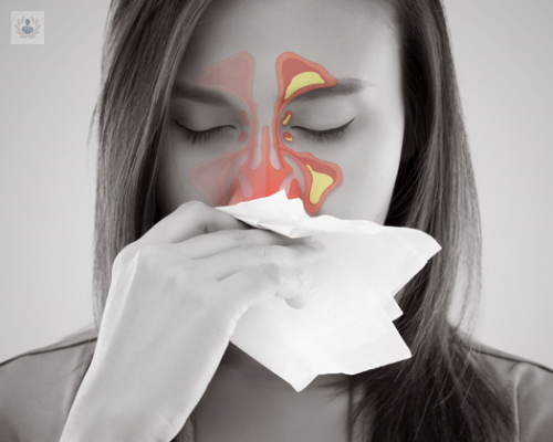sinusitis-un-tratamiento-adecuado-puede-evitar-graves-consecuencias imagen de artículo