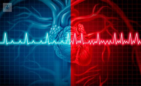 el-tratamiento-moderno-de-la-fibrilacion-auricular imagen de artículo