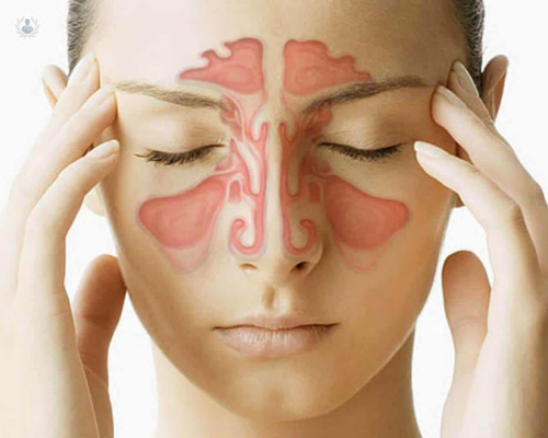 Sinusitis: tipos, causas y riesgos