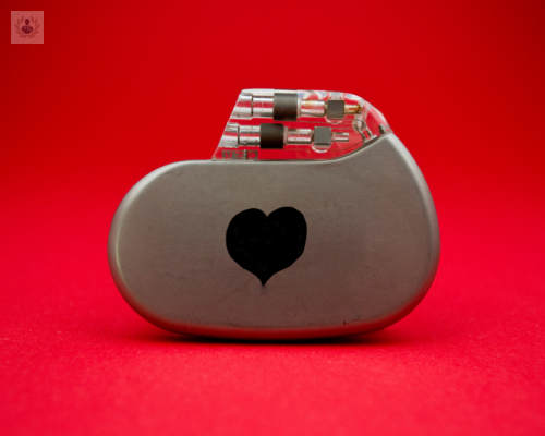 marcapasos-implicaciones-para-el-paciente imagen de artículo