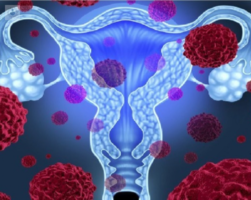 sintomas-del-virus-del-papiloma-humano-vph imagen de artículo