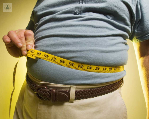 ¿Cuáles son las principales causas de la Obesidad? 