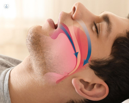 apnea-del-sueno-cual-es-el-mejor-tratamiento imagen de artículo