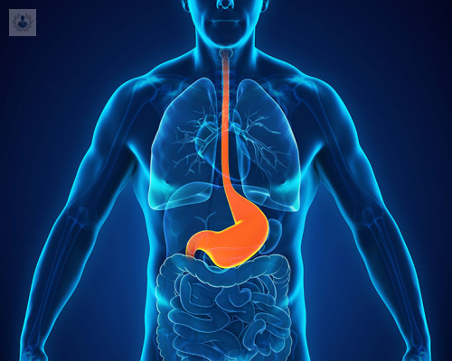 cirugia-antirreflujo-una-opcion-para-el-tratamiento-del-reflujo-gastroesofagico imagen de artículo
