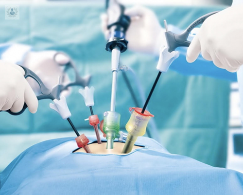cirugia-laparoscopica-sus-beneficios-dentro-de-la-ginecologia-y-obstetricia imagen de artículo