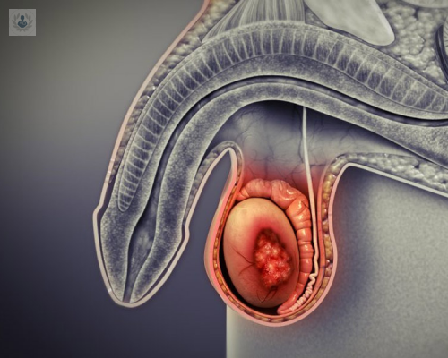 cancer-de-testiculo-un-padecimiento-facil-de-diagnosticar-pero-con-atencion-tardia imagen de artículo