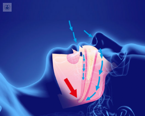 la-apnea-obstructiva-del-sueno-afecta-a-ninos-y-adolescentes imagen de artículo