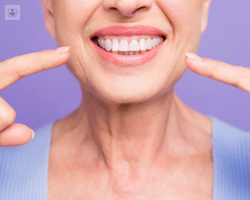 Implantes Dentales ¿qué son y para qué sirven? ventajas y riesgos