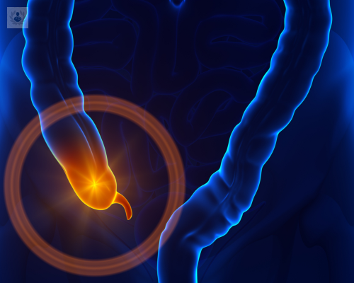 apendicitis-aguda-factores-de-riesgo-y-tratamiento imagen de artículo