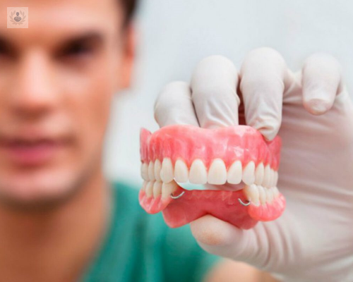 Beneficios, desventajas y la importancia de las prótesis dentales