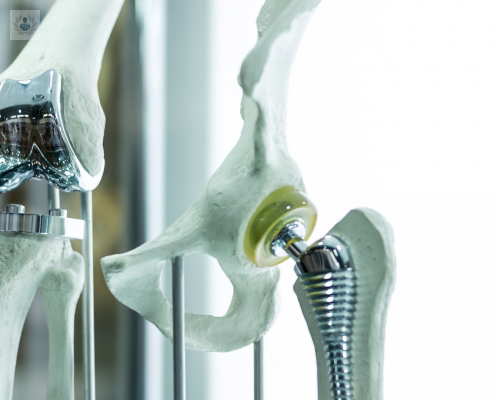 protesis-de-cadera-y-rodilla-existe-solo-un-tipo imagen de artículo