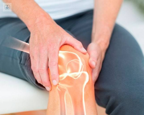 ¿Cuáles son los síntomas de la Gonartrosis o desgaste de rodilla?