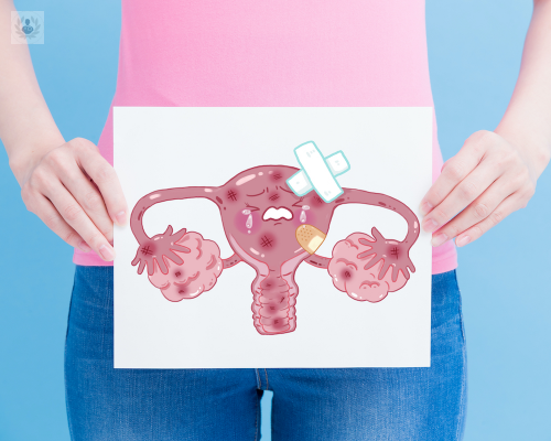 Síndrome de Ovario Poliquístico: una enfermedad prevenible