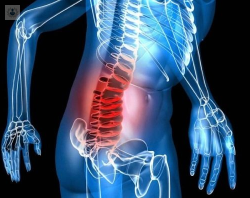 mieloma-multiple-una-enfermedad-incurable-que-afecta-los-huesos imagen de artículo