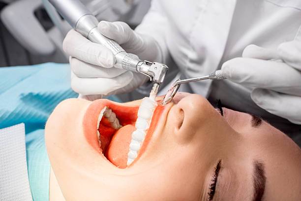 ¡Sonríe con confianza! Descubre cada cuándo realizarte una Limpieza Dental