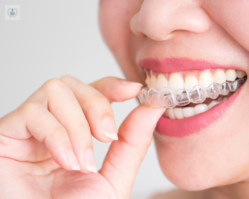 Los beneficios de los alineadores dentales y la ortodoncia