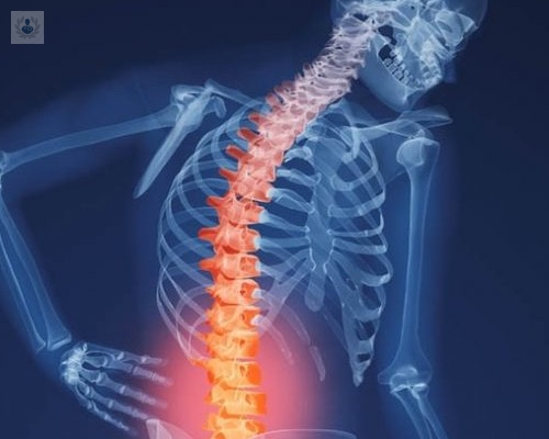 cirugia-de-columna-como-se-realiza-y-cuales-son-los-beneficios imagen de artículo