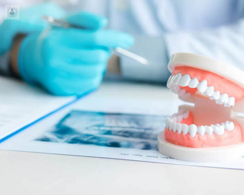 Prótesis Dentales Removibles: tipos, ventajas y desventajas  