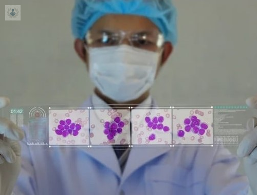 que-mas-debo-saber-acerca-de-la-leucemia imagen de artículo