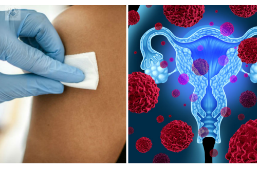 el-virus-del-papiloma-humano-vph-tiene-cura imagen de artículo