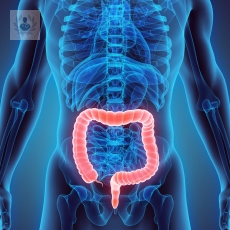 colitis-que-es-y-comose-cura imagen de artículo