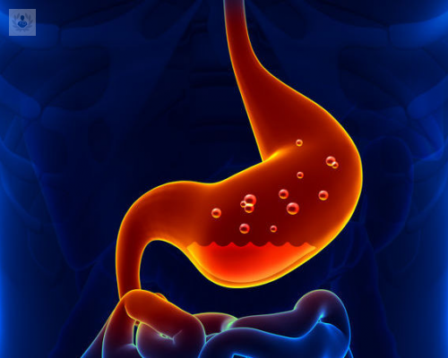 el-estres-causa-la-gastritis imagen de artículo