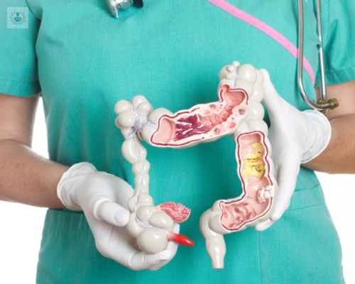 colonoscopia-de-checkup-a-que-edad-se-recomienda imagen de artículo