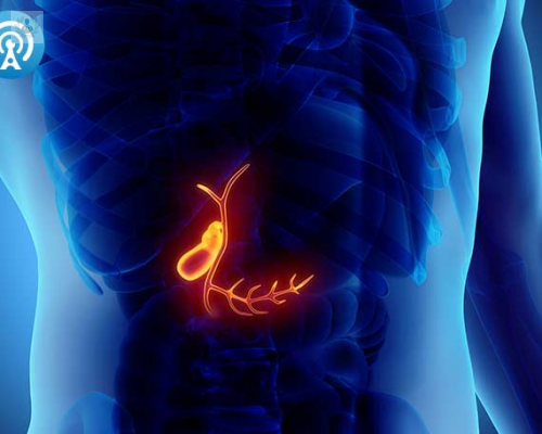 litiasis-biliar-que-es-y-cual-es-el-tratamiento imagen de artículo
