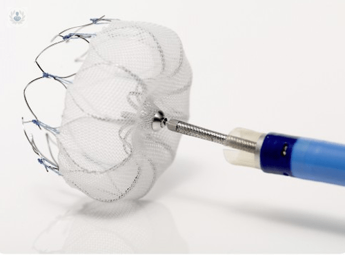 cierre-de-orejuela-izquierda-una-cirugia-contra-los-coagulos-en-el-corazon imagen de artículo